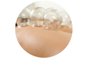 Cupping Image
