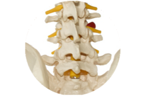 Dorn Method Image